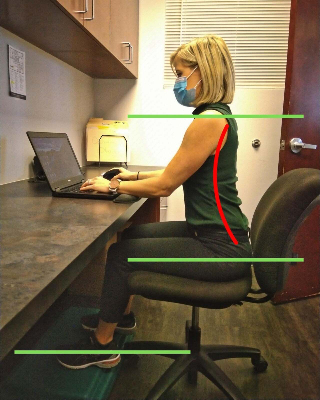 Bad posture - back is pushed too far forward