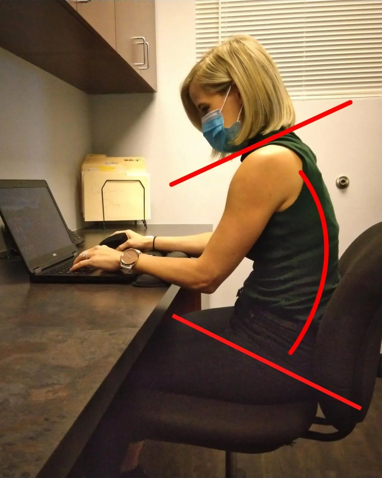 Bad posture - hunched back