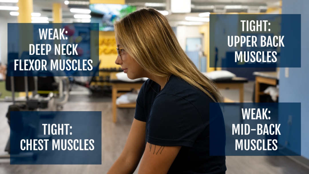 Image of a woman displaying bad posture. Image reads: weak: neck, flexor muscles. Tight: upper back and muscles. tight: chest muscles. and weak: mid-back muscles.