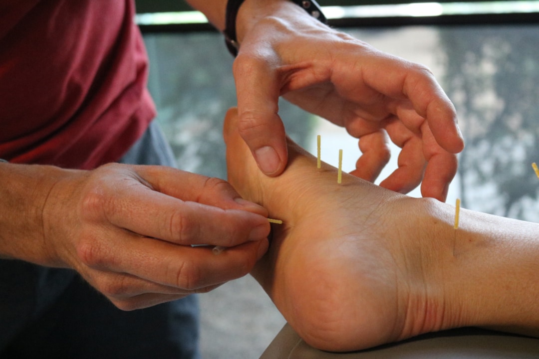 What is Electro-Dry Needling and how can it help with chronic pain and  injury treatment?