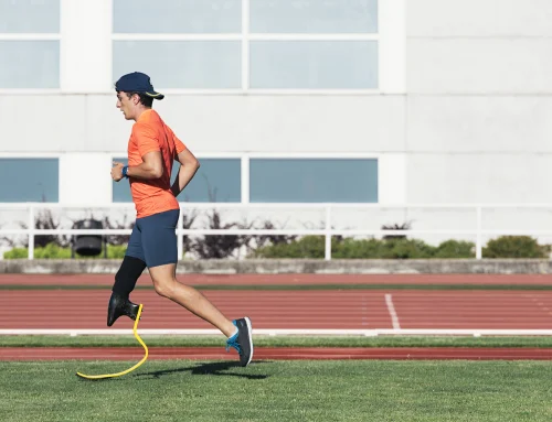 Life After Amputation: Get Moving Again with Physical Therapy